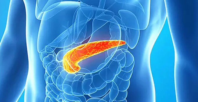 Pankreas kanseri teşhisinde yapay zeka ihtilali