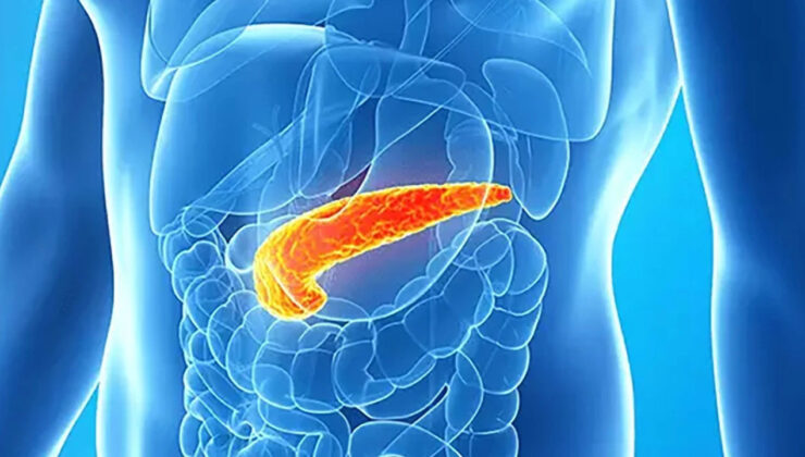 Pankreas kanseri teşhisinde yapay zeka ihtilali
